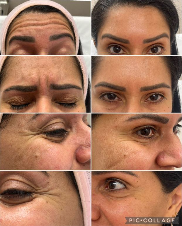 FOTOS RESULTADOS 23